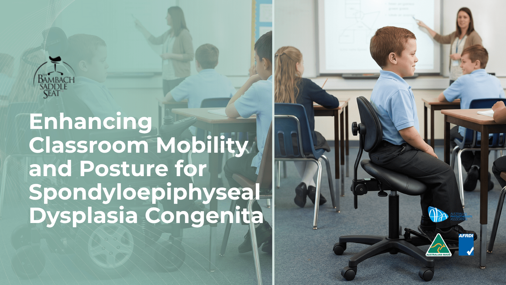 spondyloepiphyseal dysplasia seating
